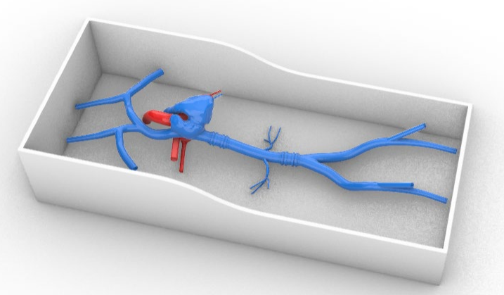 電生理心臟模型
